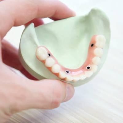 DENTURES